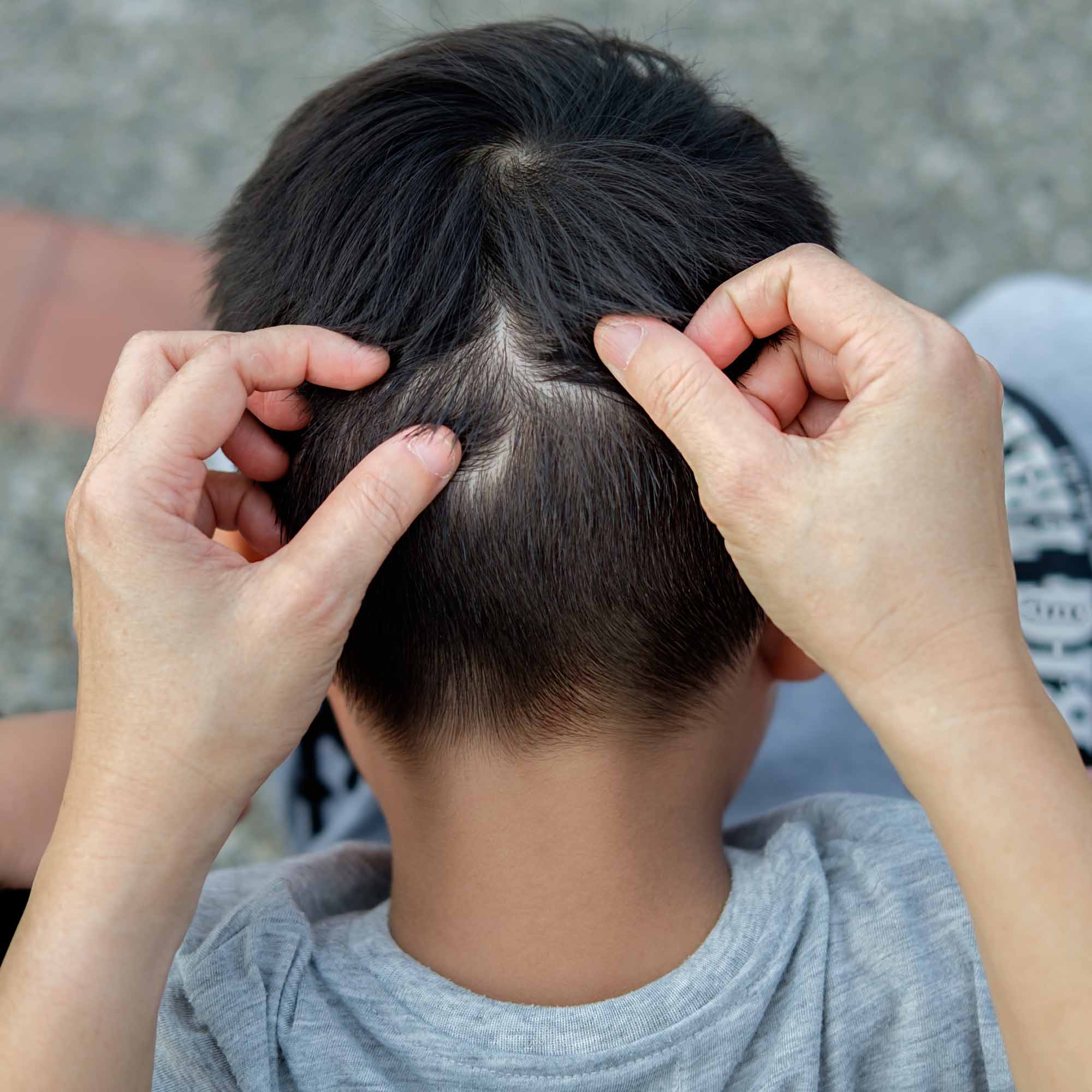 Mehr Informationen zum Thema: Kopfläuse bei Kindern